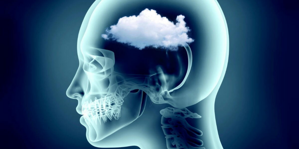 The Top 5 Causes of Brain Fog